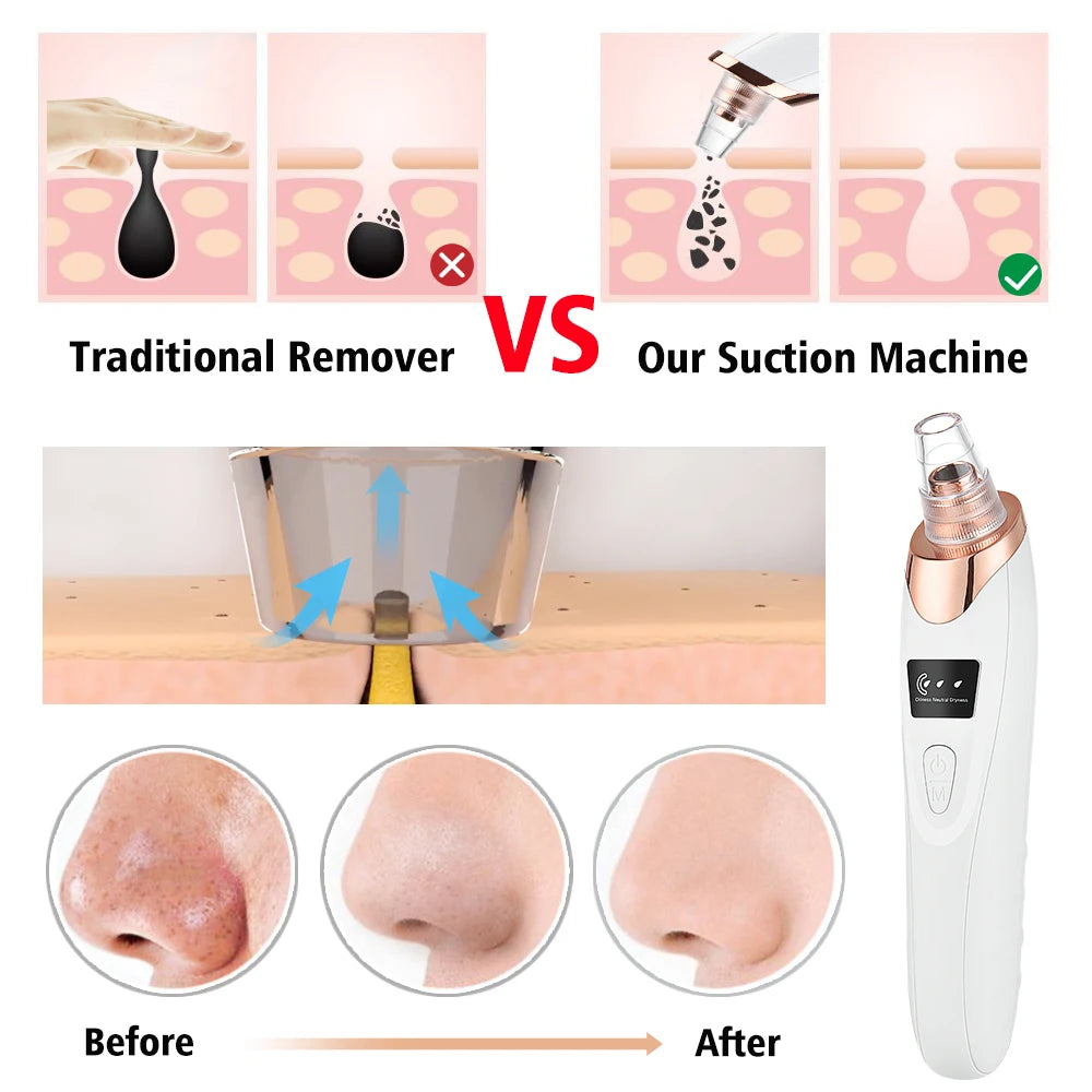 3 Suction Mode Blackhead Remover Face Cleansing Beauty Machine Dead Skin Remover Face Vacuum Blackhead Removal Skin Care Tool