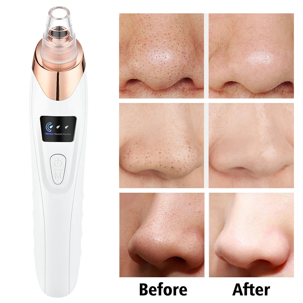 3 Suction Mode Blackhead Remover Face Cleansing Beauty Machine Dead Skin Remover Face Vacuum Blackhead Removal Skin Care Tool